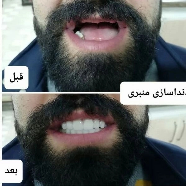 1698652548599.webp
