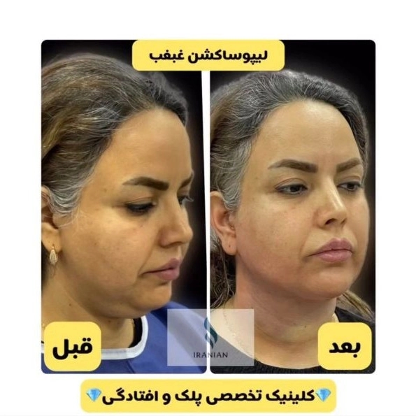 1722336602325.webp