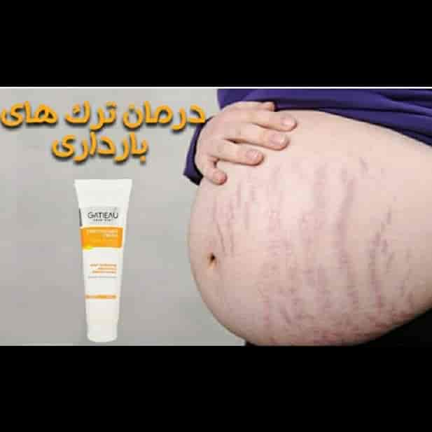 کرم استرچ مارک گاتیو