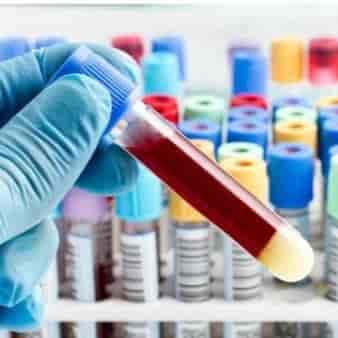 لوله های ژلدار وکیوم VLAB