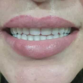 1697269267702.webp
