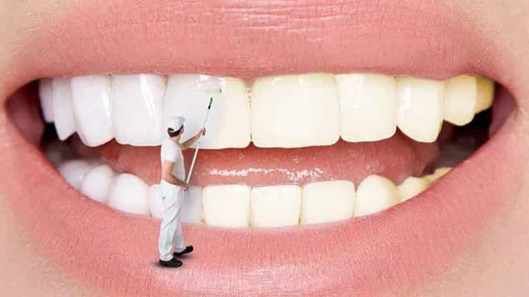 علل تغییر رنگ دندانها