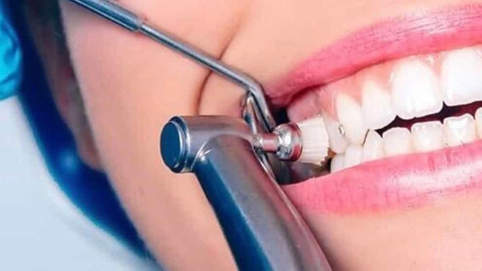 چگونه زیبایی دندان خود را بازسازی کنیم؟