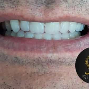 1710547015706.webp