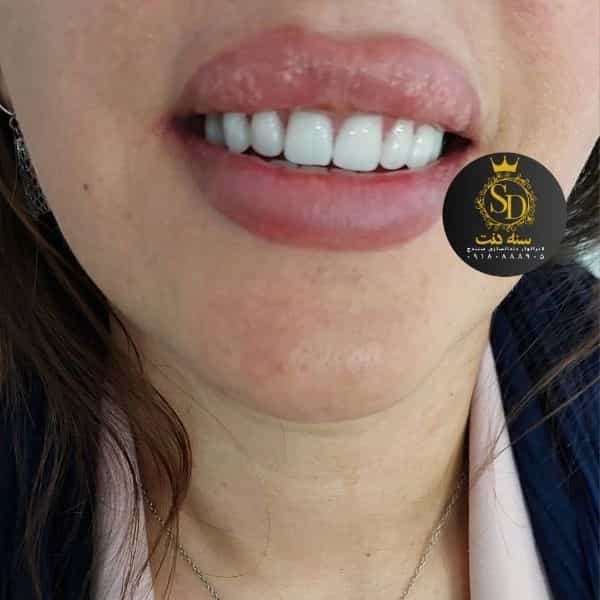 1710548116675.webp