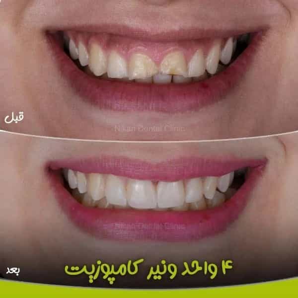 1717047253245.webp