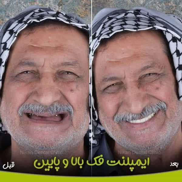 1717047376414.webp