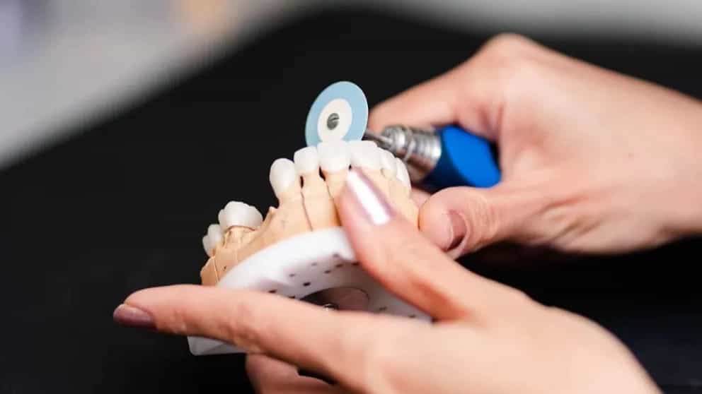 منظور از لابراتوار دندانسازی چیست؟