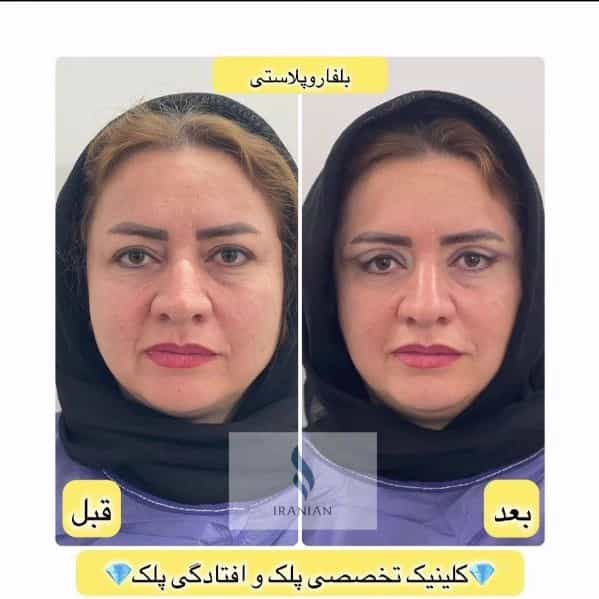 1722336616192.webp